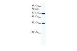 FoxF1 Antibody, Novus Biologicals 100 &mu;L; Unconjugated:Antibodies, Polyclonal
